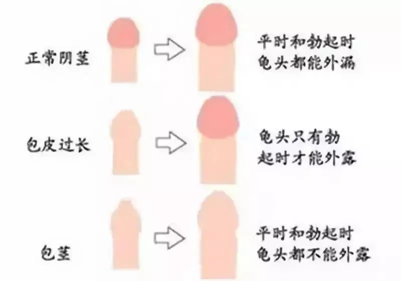 0011dff47a2cff6db6ac5f677172b3be.jpg