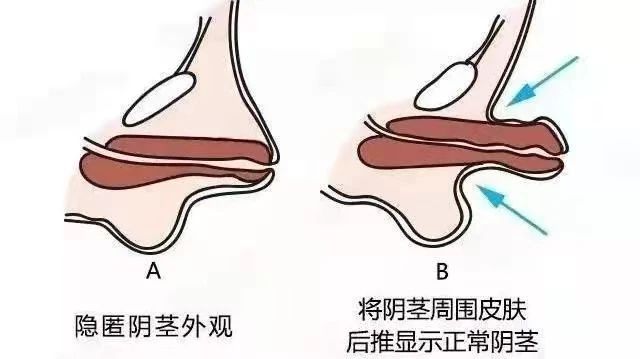 349855703d1cd67cd73c5c27fc794866.jpg