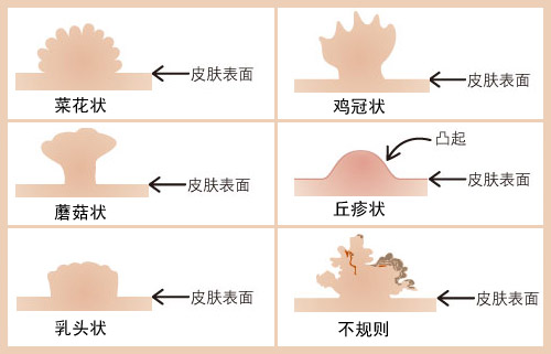 5553c4f5eb54a5c21f94ca898f118292.png