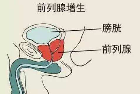07d46995a52b14d3a91799126096195d.png
