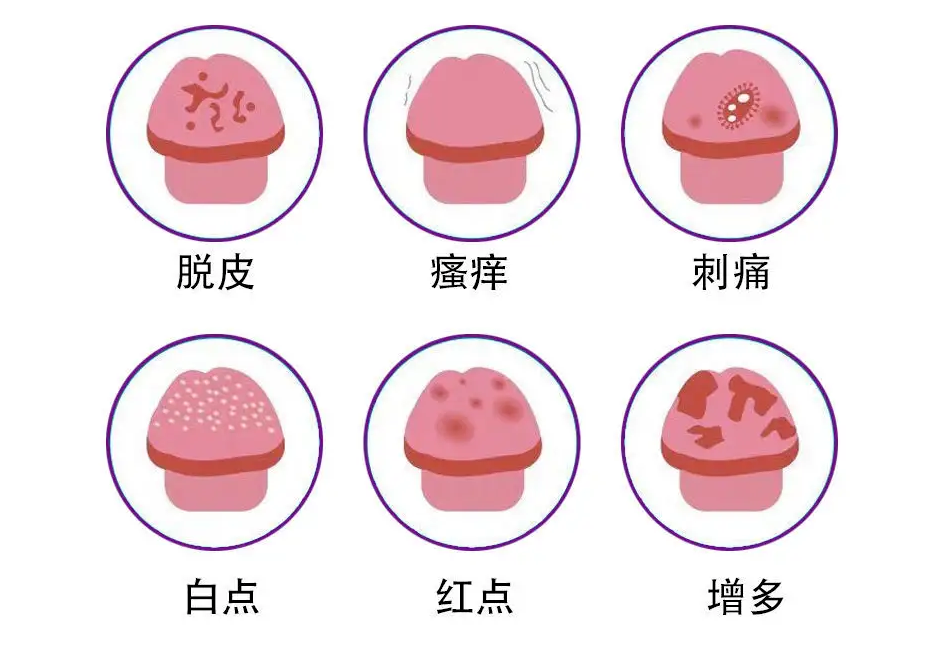 618229cc20e2762877177355c5233055.png