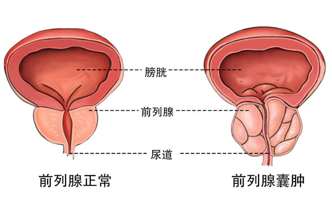 55f45ec77b9481d5909626f4892ec94e.png